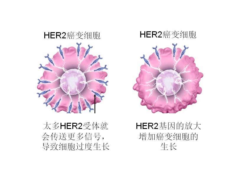 香港内科肿瘤科医生杨明明：新一代药物 有望变革HER2型乳腺癌治疗方案